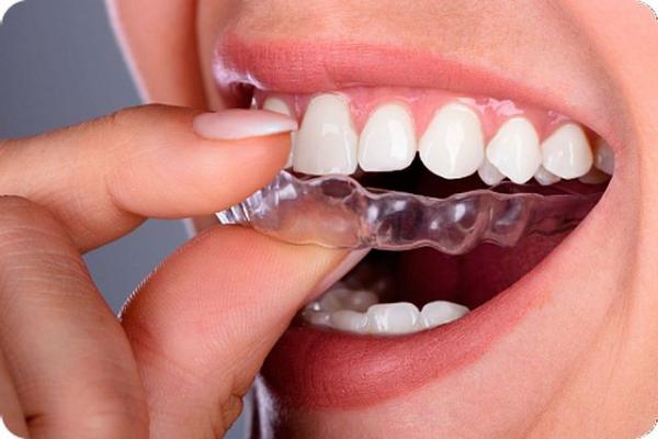 аномальный прикус аномальный прикус