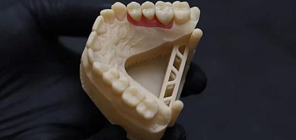 протезирование зубов протезирование зубов