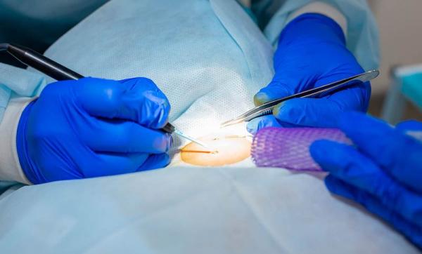 Хирургическая помощь в Казани Хирургическая помощь в Казани